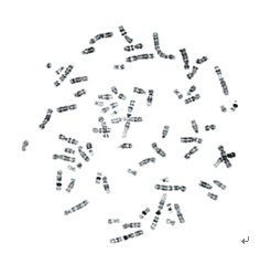 BandView染色體條帶分析系統(tǒng)